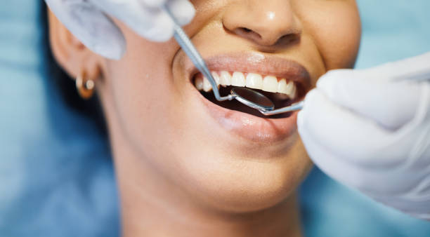 Best Chipped Tooth Repair Near Me  in Kilmarnock, VA